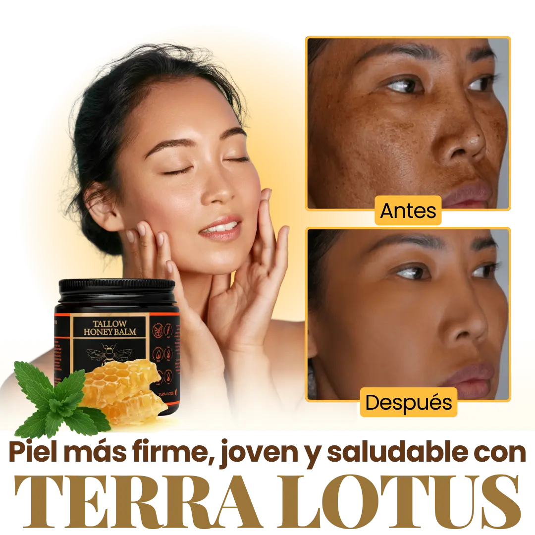 Terra Lotus