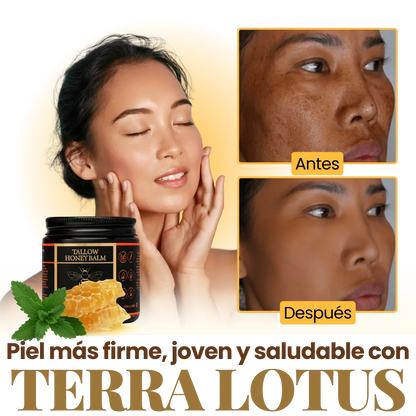 Terra Lotus